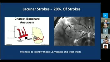 The Future of Neurosurgery and Medicine; James Ausman MD; Lenticulostriate arteries; Atherosclerosis Treatment; Macrophages and Aneurysm growth; Micron-vascular disease Treatment