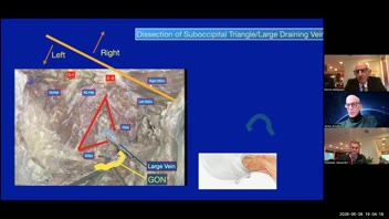 Practical Surgical Anatomy of the CP Angle; Dennis Malkasian