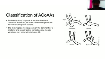 Anterior Communicating Artery Aneurysms- Hernesniemi's Perspective.